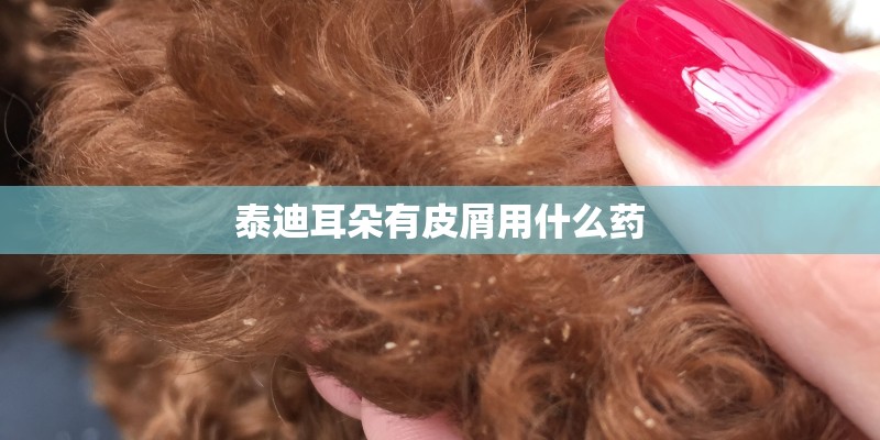 泰迪耳朵有皮屑用什么药 泰迪耳朵有皮屑用什么药